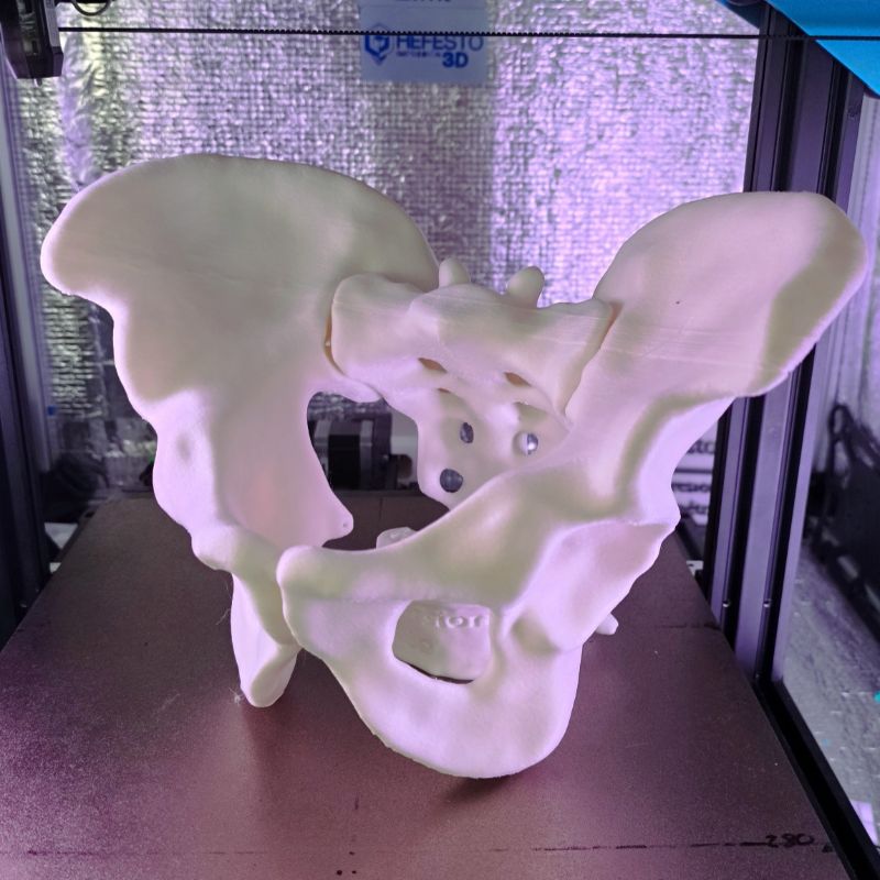 Pelvis completa